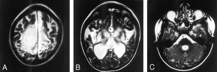 Fig 3.