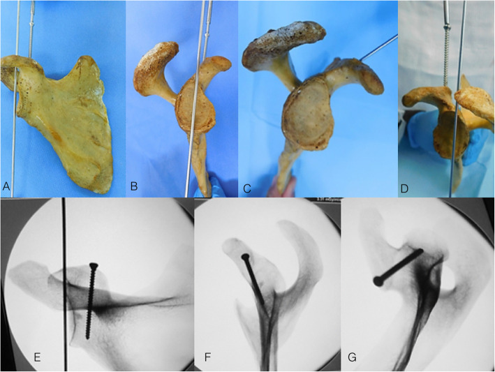 Fig. 10