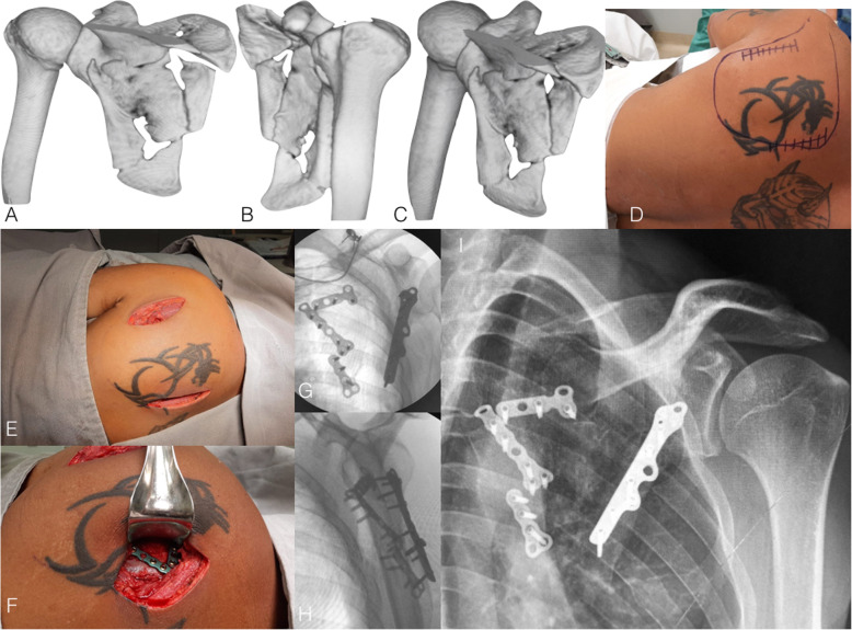 Fig. 3