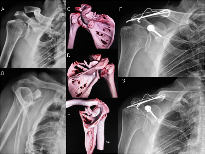 Fig. 11