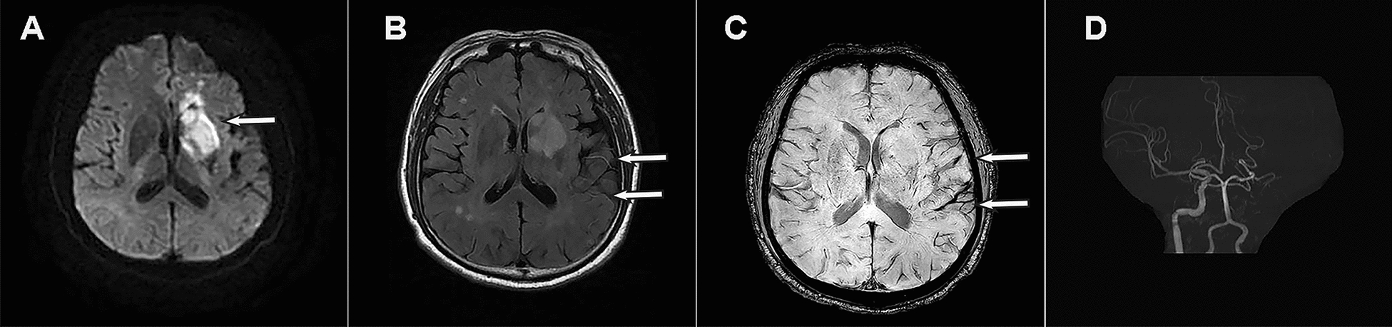 Fig. 4