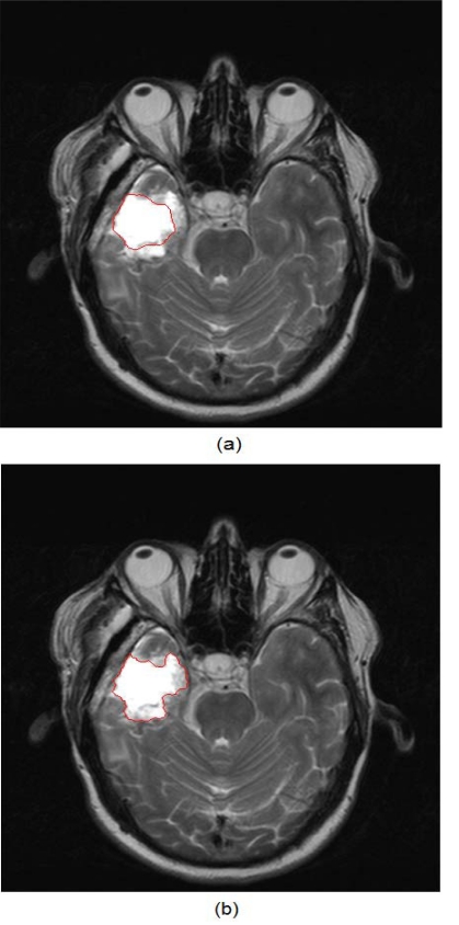 Fig. (7)