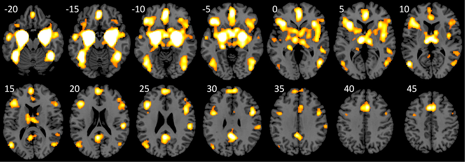 Fig. 3