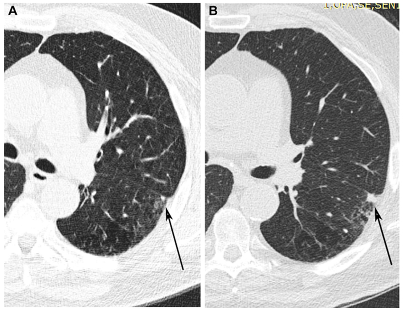 Figure 3 (A and B):