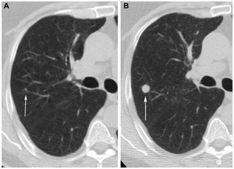 Figure 1 (A and B):