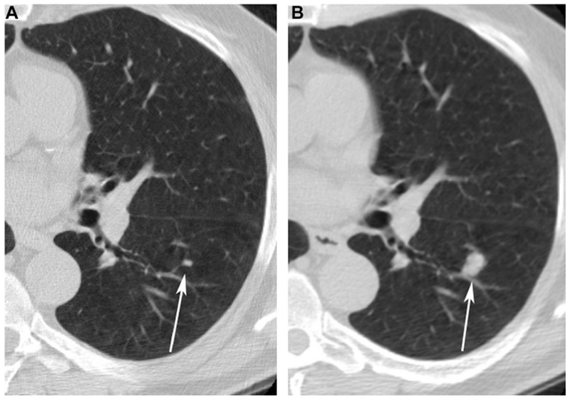 Figure 2 (A and B):