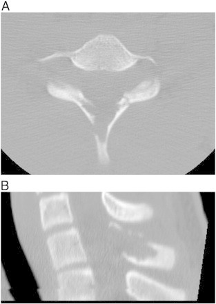 Fig 2