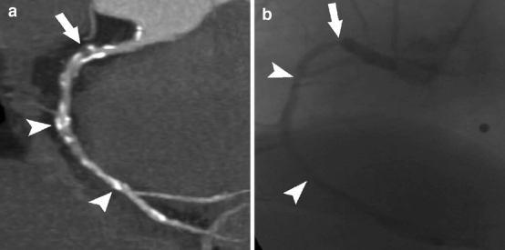 Fig. 2a, b