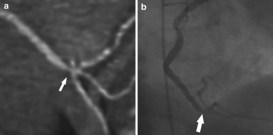 Fig. 3a, b