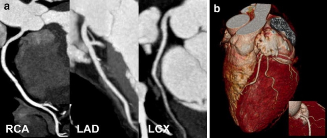 Fig. 1a, b