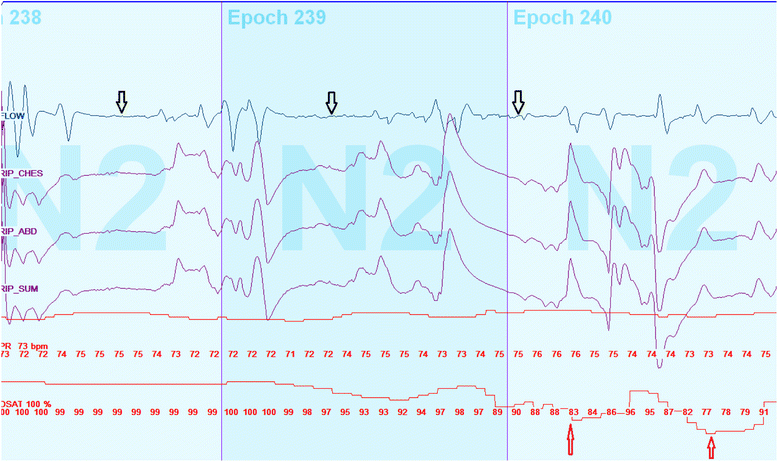 Fig. 2