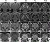 Fig 6.