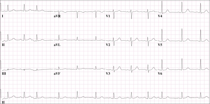 Figure 2)