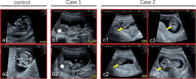 Fig.2