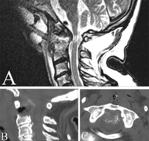 Fig. 3