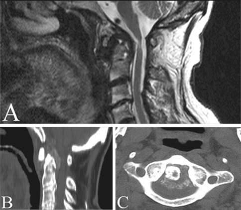 Fig. 2