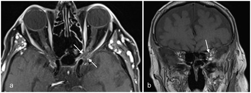 Figure 11.