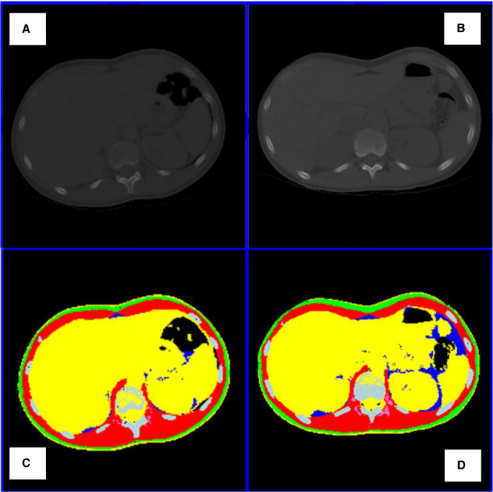 FIGURE 1