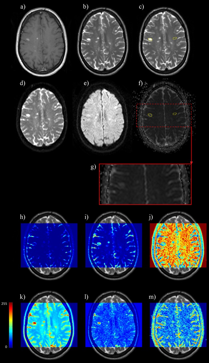 Fig 1