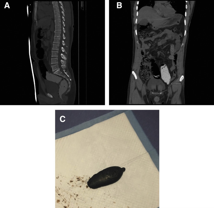 Fig. 2