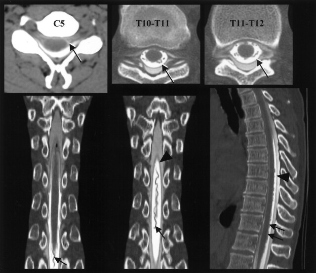 Fig 2.