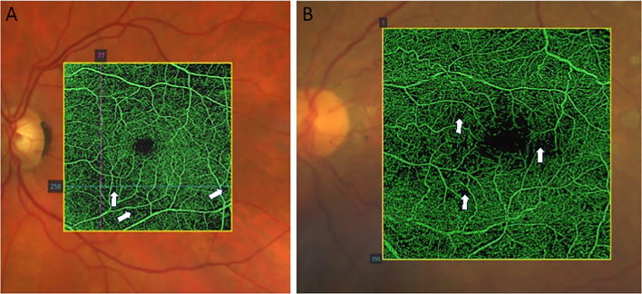 Fig. 2