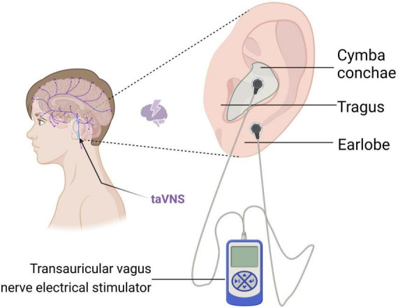 FIGURE 3