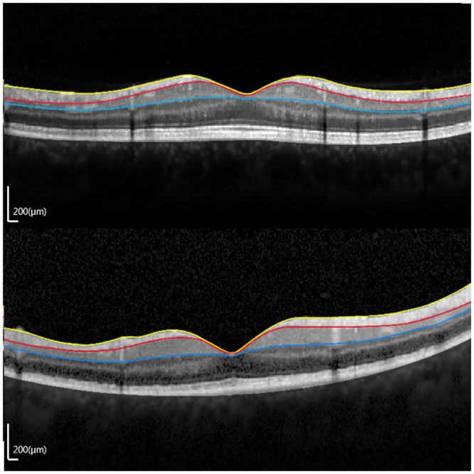 Fig 4