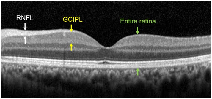 Fig 2