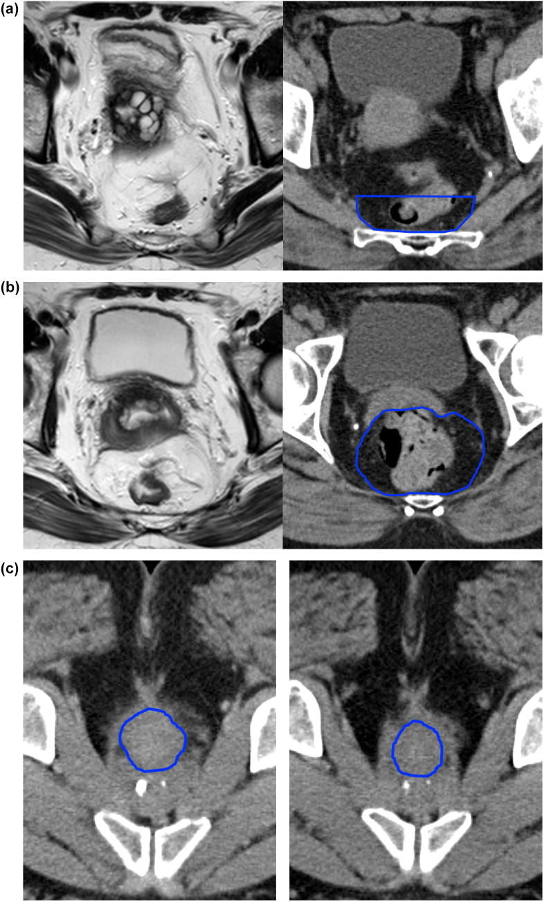 Fig 5