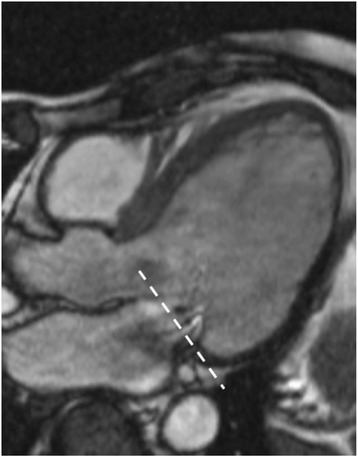 Fig. 13