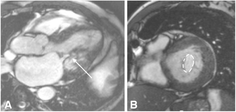 Fig. 10