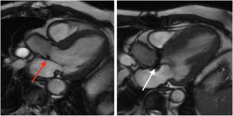 Fig. 16