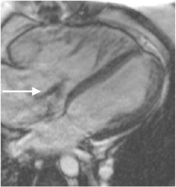 Fig. 15