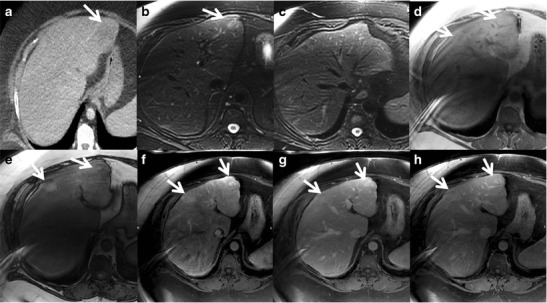 Fig. 7