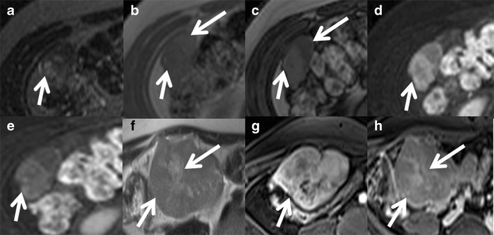 Fig. 9