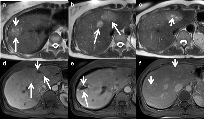 Fig. 10