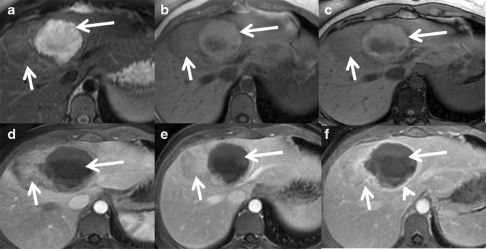 Fig. 12