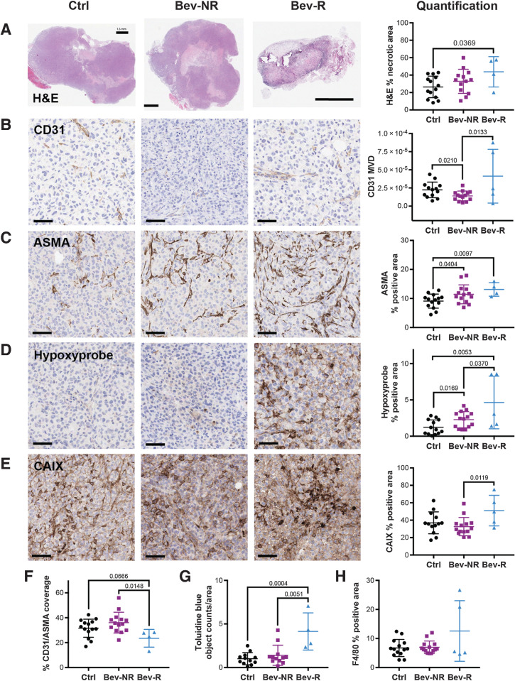 Figure 5. Ex vivo histopathologic analysis of the tumor vascular microenvironment explains the PAT findings. A, H&E staining. Scale bar, 1.5 mm. Necrosis is significantly higher in the Bev-R group compared with Ctrl (Ctrl ntumors = 14, Bev-NR ntumors = 13, Bev-R ntumors = 4). B, CD31 positive MVD (vessel/μm2) was significantly higher for the Bev-R group compared with the Bev-NR group, which itself was lower than Ctrl (Ctrl ntumors = 14, Bev-NR ntumors = 13, Bev-R ntumors = 5). C, ASMA positivity was significantly higher in both the Bev-NR and Bev-R groups compared with Ctrl (Ctrl ntumors = 14, Bev-NR ntumors = 14, Bev-R ntumors = 4). D, Hypoxyprobe, denoting areas of hypoxia-dependent pimonidazole labeling in the tumor tissue, was significantly higher for the Bev-R group compared with the Bev-NR group, which itself was higher than Ctrl (Ctrl ntumors = 13, Bev-NR ntumors = 14, Bev-R ntumors = 5). E, CAIX positivity, which also reflects tissue hypoxia, was significantly increased in the Bev-R group compared with the Bev-NR group (Ctrl ntumors = 13, Bev-NR ntumors = 14, Bev-R ntumors = 5). F, Coverage of CD31-positive vessels by ASMA staining was significantly lower in the Bev-R group compared with Bev-NR and also lower than Ctrl (Ctrl ntumors = 14, Bev-NR ntumors = 14, Bev-R ntumors = 4). G, Toluidine blue positive objects per mm2, reflective of mast cell density in the tumor, were significantly higher in Bev-NR compared with Bev-R and Ctrl groups (Ctrl ntumors = 12, Bev-NR ntumors = 12, Bev-R ntumors = 4), though no significant differences in F4/80 staining (H), reflecting macrophages, was observed (Ctrl ntumors = 14, Bev-NR ntumors = 14, Bev-R ntumors = 5). Scale bars = 50 µm; P values are displayed from two-sided Student t tests.