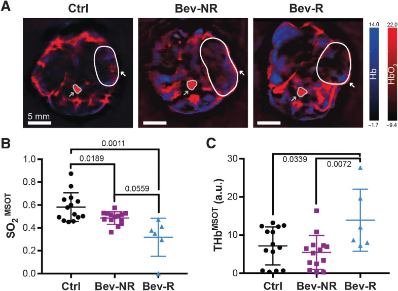 Figure 3. PAT detects changes in tumor vasculature in response to bevacizumab treatment. A, Representative PAT images at endpoint denoting deoxyhemoglobin (Hb) on the blue color scale and oxyhemoglobin (HbO2) on the red color scale. Regions of interest shown denote the position of one tumor per mouse (white outline and arrow) and the aorta/vena cava (gray outline and arrow), used as a reference. B, Tumor oxygenation extracted from PAT images (SO2MSOT) shows a significant decrease in both Bev-NR and Bev-R groups compared with Ctrl. The Bev-R group also has significantly lower oxygenation than the Bev-NR group. C, Hemoglobin content extracted from PAT images (THbMSOT) is significantly elevated in the Bev-R group compared with both Bev-NR and Ctrl. Ctrl ntumors = 14, Bev-NR ntumors = 14, Bev-R ntumors = 6; scale bars 5 mm; P values are displayed from two-sided Welch (B) and Student (C) t tests.