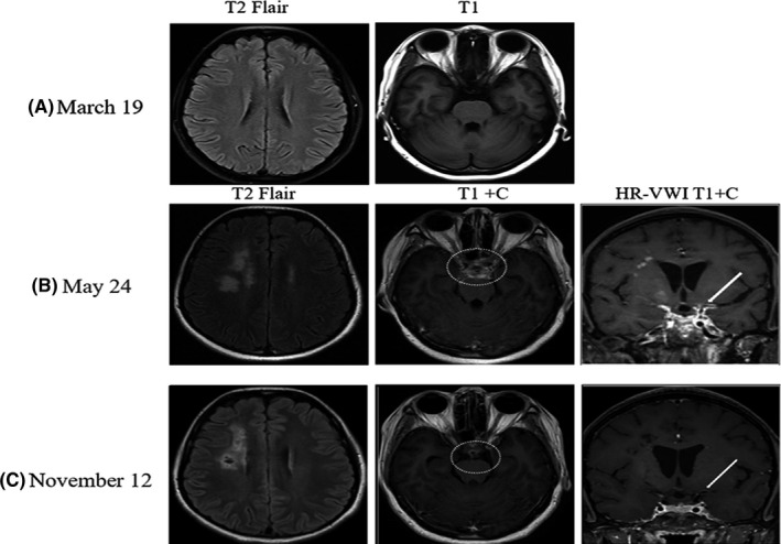 FIGURE 2