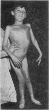 118