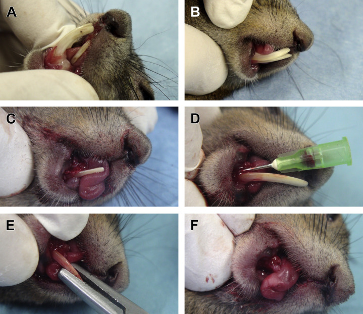 Fig. 15