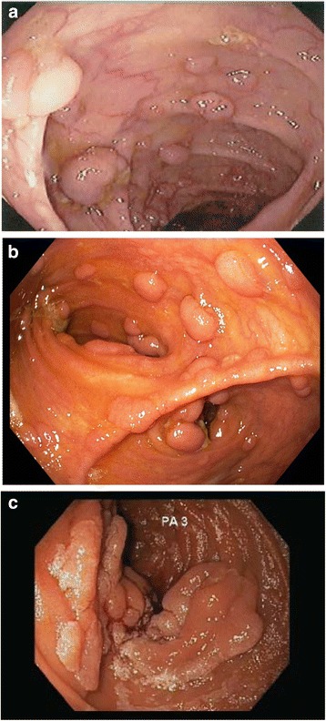 Fig. 2