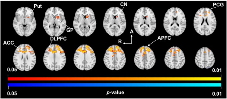 Fig 3