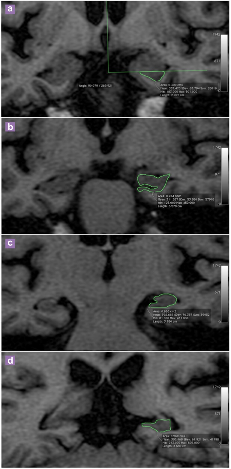 Figure 1: