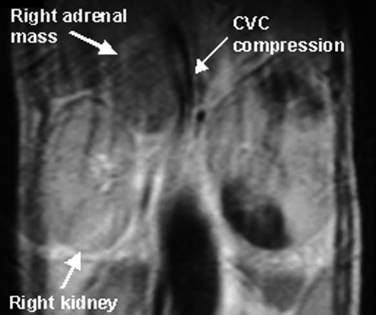 Fig 2.