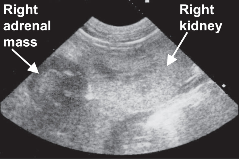 Fig 1.