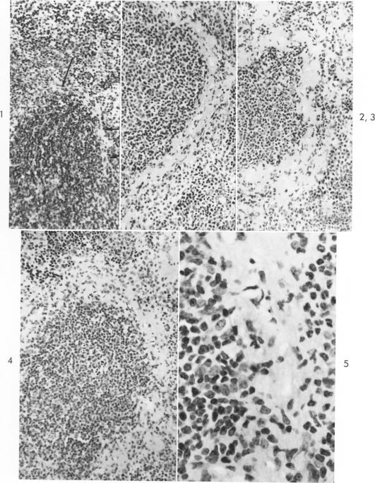 Fig. 1-5