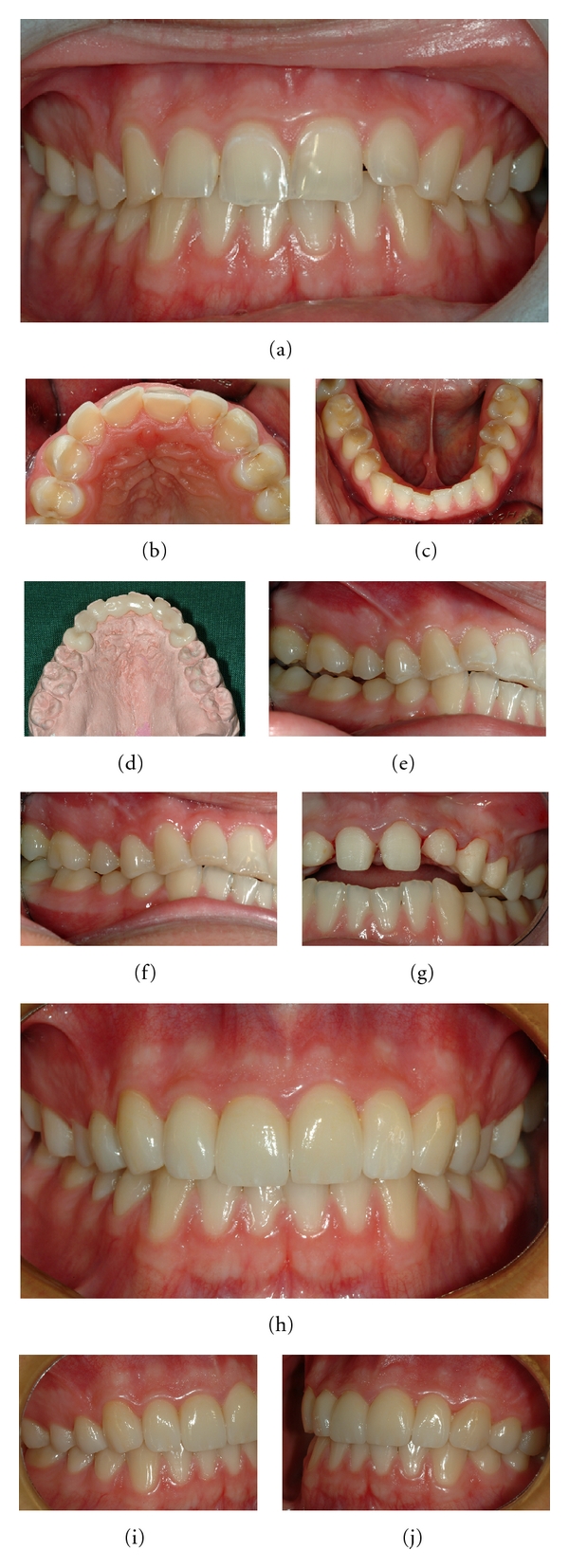 Figure 12